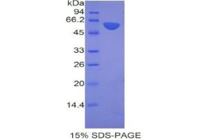 SDS-PAGE analysis of Mouse ANP32A Protein. (PHAP1 蛋白)
