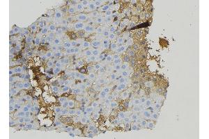 ABIN6274923 at 1/100 staining Mouse liver tissue by IHC-P. (BRP44L 抗体  (Internal Region))