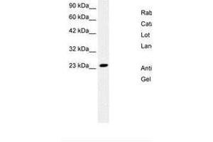 Image no. 2 for anti-MYST/Esa1-Associated Factor 6 (MEAF6) (N-Term) antibody (ABIN6736265) (MEAF6 抗体  (N-Term))