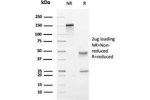 SDS-PAGE Analysis Purified PMEPA1 Mouse Monoclonal Antibody (PMEPA1/2697). (PMEPA1 抗体)