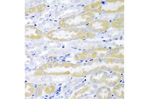 Immunohistochemistry of paraffin-embedded mouse kidney using FABP6 antibody at dilution of 1:200 (40x lens). (FABP6 抗体)