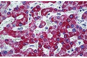 Human Liver: Formalin-Fixed, Paraffin-Embedded (FFPE) (CPS1 抗体  (AA 1400-1501))