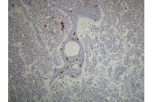 Immunohistochemistry (IHC) image for anti-CD1a (CD1a) (AA 240-256), (C-Term) antibody (ABIN870499) (CD1a 抗体  (C-Term))