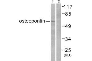 Western blot analysis of extracts from LOVO cells, using osteopontin antibody (ABIN5976474). (Osteopontin 抗体  (C-Term))