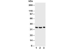 Western blot testing of Granzyme A antibody and Lane 1:  Jurkat;  2: CEM;  3: Raji cell lysate (GZMA 抗体  (Middle Region))