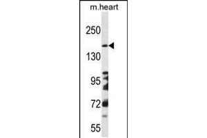 Western blot analysis in mouse heart tissue lysates (35ug/lane). (DCC 抗体  (AA 643-670))