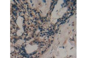 Used in DAB staining on fromalin fixed paraffin- embedded Kidney tissue (ADAMTS10 抗体  (AA 239-602))