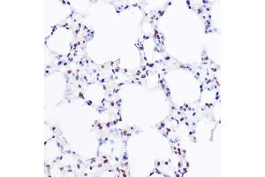Immunohistochemistry (IHC) image for anti-SWI/SNF Related, Matrix Associated, Actin Dependent Regulator of Chromatin, Subfamily A, Member 4 (SMARCA4) (AA 30-130) antibody (ABIN3022959)