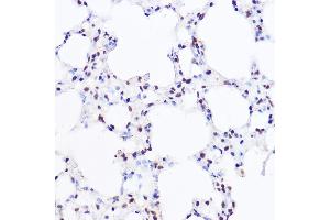Immunohistochemistry of paraffin-embedded mouse lung using [KO Validated] BRG1/BRG1/SM Rabbit pAb (ABIN3022958, ABIN3022959, ABIN3022960 and ABIN6219317) at dilution of 1:100 (40x lens).