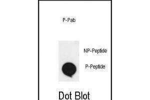 Dot blot analysis of anti-phospho-EphA2-p Phospho-specific Pab (ABIN650858 and ABIN2839809) on nitrocellulose membrane. (EPH Receptor A2 抗体  (pSer897))