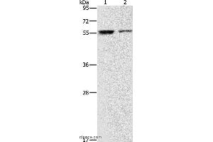Western blot analysis of Jurkat and 293T cell, using ARHGAP15 Polyclonal Antibody at dilution of 1:500 (ARHGAP15 抗体)
