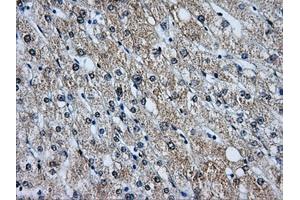 Immunohistochemistry (IHC) image for anti-Baculoviral IAP Repeat-Containing 7 (BIRC7) antibody (ABIN1499181) (BIRC7 抗体)