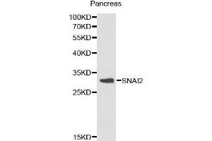 Western Blotting (WB) image for anti-Snail Family Zinc Finger 2 (SNAI2) (AA 89-268) antibody (ABIN6214866) (SLUG 抗体  (AA 89-268))