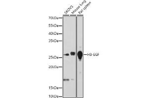 Western blot analysis of extracts of various cell lines, using HB-EGF antibody (ABIN7267616) at 1:1000 dilution. (HBEGF 抗体)