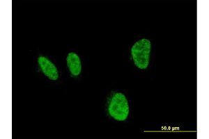 Immunofluorescence of monoclonal antibody to HOXA5 on HeLa cell. (HOXA5 抗体  (AA 171-270))