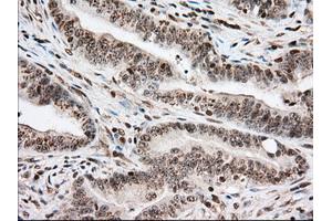 Immunohistochemical staining of paraffin-embedded Human pancreas tissue using anti-USP5 mouse monoclonal antibody. (USP5 抗体)