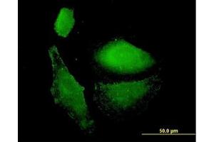 Image no. 3 for anti-Vesicle-Associated Membrane Protein 1 (Synaptobrevin 1) (VAMP1) (AA 28-97) antibody (ABIN598952) (VAMP1 抗体  (AA 28-97))
