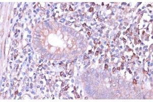 Immunohistochemistry of paraffin-embedded Human appendix using PRKACB Polyclonal Antibody at dilution of 1:100 (40x lens). (PRKACB 抗体)