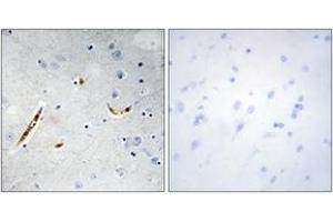 Immunohistochemistry analysis of paraffin-embedded human brain tissue, using TCF3 Antibody. (TCF3 抗体  (AA 571-620))