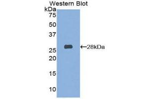Western Blotting (WB) image for anti-Hexosaminidase A (HEXA) (AA 319-528) antibody (ABIN1859137) (Hexosaminidase A 抗体  (AA 319-528))