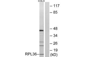 Western blot analysis of extracts from COLO cells, using RPL36 antibody. (RPL36 抗体  (Internal Region))
