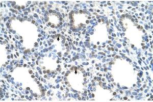 Immunohistochemistry (IHC) image for anti-Solute Carrier Family 15 (H+/Peptide Transporter), Member 4 (SLC15A4) (N-Term) antibody (ABIN2781719)