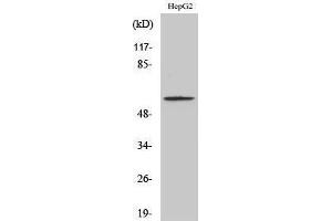 Western Blotting (WB) image for anti-SMAD, Mothers Against DPP Homolog 2 (SMAD2) (pSer467) antibody (ABIN3182472) (SMAD2 抗体  (pSer467))