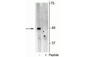 Western blot of Jurkat cell lysate showing specific immunolabeling of the ~48 kDa p62 phosphorylated at Ser28 in the first lane (-). (SQSTM1 抗体  (pSer28))