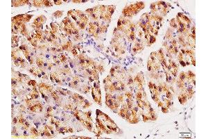 Formalin-fixed and paraffin embedded rat pancreas tissue labeled with Anti-ACE2 Polyclonal Antibody, Unconjugated at 1:200, followed by conjugation to the secondary antibody and DAB staining