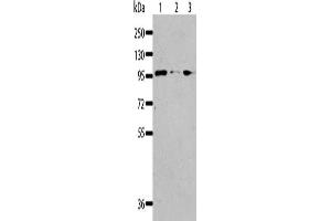 Gel: 8 % SDS-PAGE, Lysate: 40 μg, Lane 1-3: Jurkat cells, 293T cells, K562 cells, Primary antibody: ABIN7128323(AKAP8L Antibody) at dilution 1/117, Secondary antibody: Goat anti rabbit IgG at 1/8000 dilution, Exposure time: 30 seconds (AKAP8L 抗体)