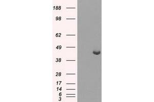 Western Blotting (WB) image for anti-Protein Phosphatase Methylesterase 1 (PPME1) antibody (ABIN1500296) (PPME1 抗体)