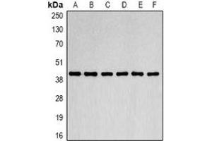 Western blot analysis of Beta-actin expression in Jurkat (A), MCF7 (B), NIH3T3 (C), mouse brain (D), rat brain (E), COS7 (F) whole cell lysates. (beta Actin 抗体)