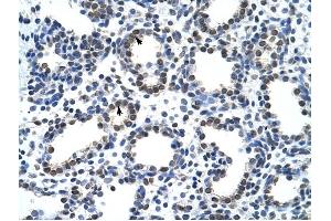 CARS antibody was used for immunohistochemistry at a concentration of 4-8 ug/ml to stain Alveolar cells (arrows) in Human Lung. (CARS 抗体  (N-Term))