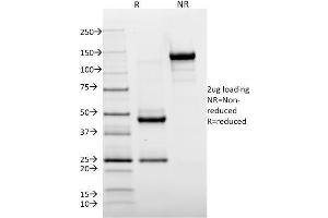 SDS-PAGE Analysis Purified HLA-DR Mouse Monoclonal Antibody (TAL 1B5). (HLA-DR 抗体)