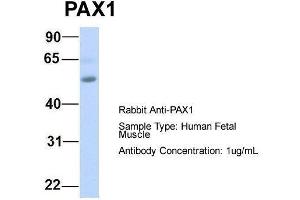 Host:  Rabbit  Target Name:  PAX1  Sample Type:  Human Fetal Muscle  Antibody Dilution:  1. (PAX1 抗体  (Middle Region))