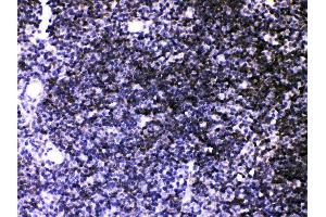 Immunohistochemistry (IHC) image for anti-ATPase, Ca++ Transporting, Ubiquitous (ATP2A3) (AA 1-30), (N-Term) antibody (ABIN3043794)