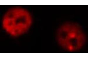 ABIN6267316 staining MOLT by IF/ICC. (Retinoblastoma 1 抗体  (pSer795))