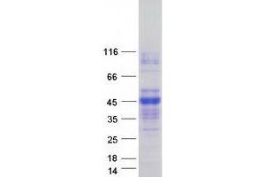 Western Blotting (WB) image for Asialoglycoprotein Receptor 2 (ASGR2) (Transcript Variant 1) protein (Myc-DYKDDDDK Tag) (ABIN2714982)