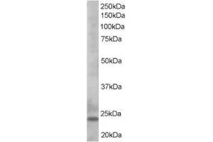 Image no. 1 for anti-BCL2-Like 11 (Apoptosis Facilitator) (BCL2L11) (C-Term) antibody (ABIN374444) (BIM 抗体  (C-Term))