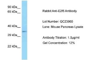 Host: Rabbit Target Name: E2f5 Sample Type: Mouse Pancreas Antibody Dilution: 1. (E2F5 抗体  (C-Term))