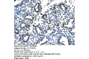 Human Lung (Claudin 17 抗体  (Middle Region))