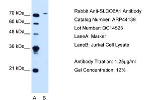 WB Suggested Anti-SLCO6A1  Antibody Titration: 1. (SLCO6A1 抗体  (C-Term))