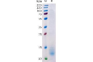 SDS-PAGE (SDS) image for Tumor Necrosis Factor Receptor Superfamily, Member 17 (TNFRSF17) (AA 1-54) protein (His tag) (ABIN6964104)
