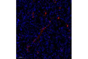 Immunofluorescence (Paraffin-embedded Sections) (IF (p)) image for anti-TBC1 (Tre-2/USP6, BUB2, Cdc16) Domain Family, Member 1 (TBC1D1) antibody (ABIN7075843)