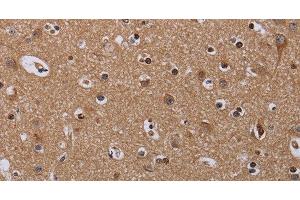 Immunohistochemistry of paraffin-embedded Human brain using MCTS1 Polyclonal Antibody at dilution of 1:60 (MCTS1 抗体)