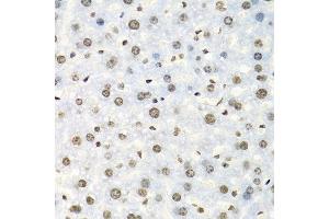 Immunohistochemistry of paraffin-embedded mouse liver using IGF2BP2 antibody at dilution of 1:100 (40x lens). (IGF2BP2 抗体)