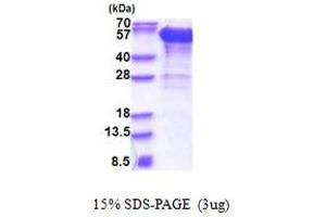 SDS-PAGE (SDS) image for Dynactin 2 (p50) (DCTN2) (AA 1-401) protein (His tag) (ABIN5853385) (Dynamitin Protein (AA 1-401) (His tag))