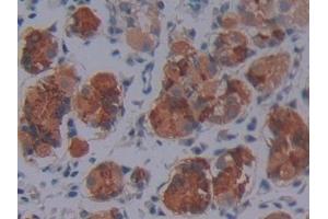 Detection of SCO2 in Human Stomach Tissue using Polyclonal Antibody to SCO Cytochrome Oxidase Deficient Homolog 2 (SCO2) (SCO2 抗体  (AA 42-266))