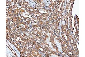 IHC analysis of PPP2CA using anti-PPP2CA antibody (ABIN3043356).