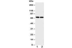 Western blot testing of Netrin 1 antibody and Lane 1:  U87;  2: COLO320 cell lysate. (Netrin 1 抗体  (AA 32-51))